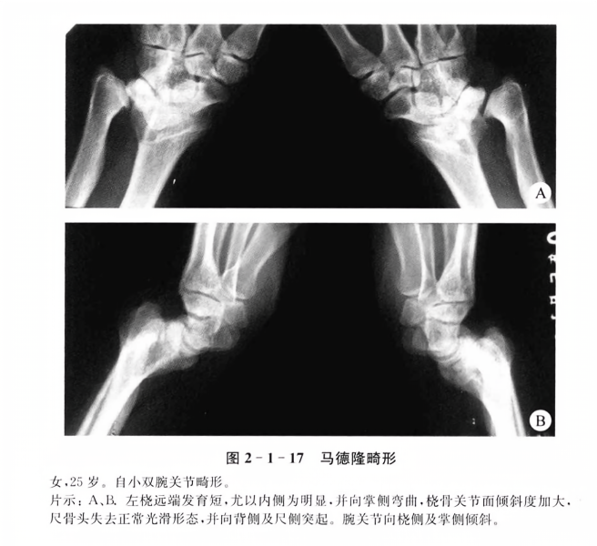 治疗方法详细步骤解析